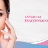 Laser. Fraccionado C02